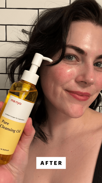 Dall'Asen after using Manyo's Pure Cleansing Oil